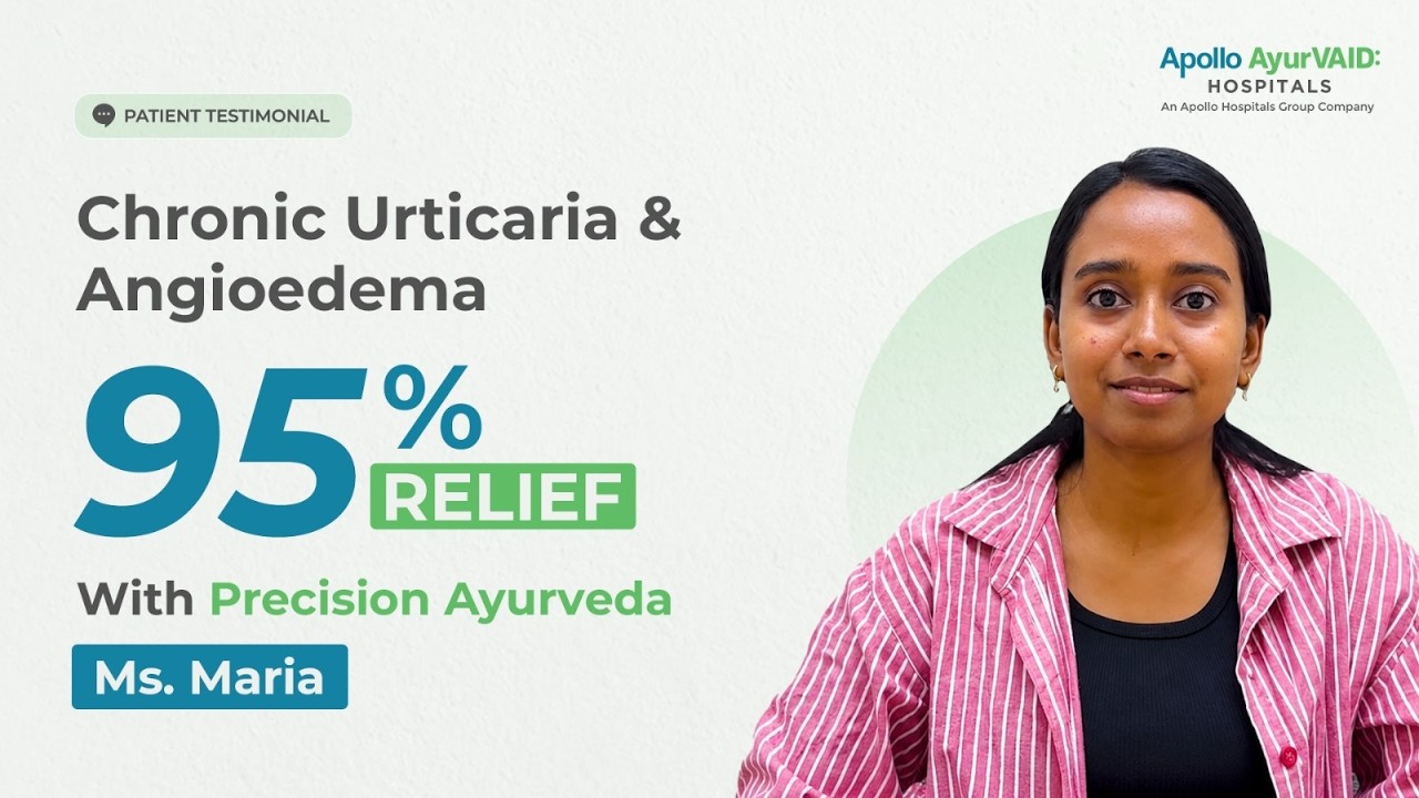 Chronic Hives & Angioedema: From Flare-Ups to 95% Symptom Relief